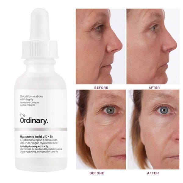 The Ordinary Hyaluronic Acid 2% +B5